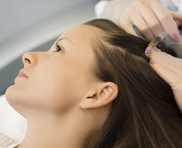 Was ist die Haar-Mesotherapie?
